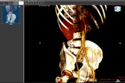 ORPALISDICOMViewer